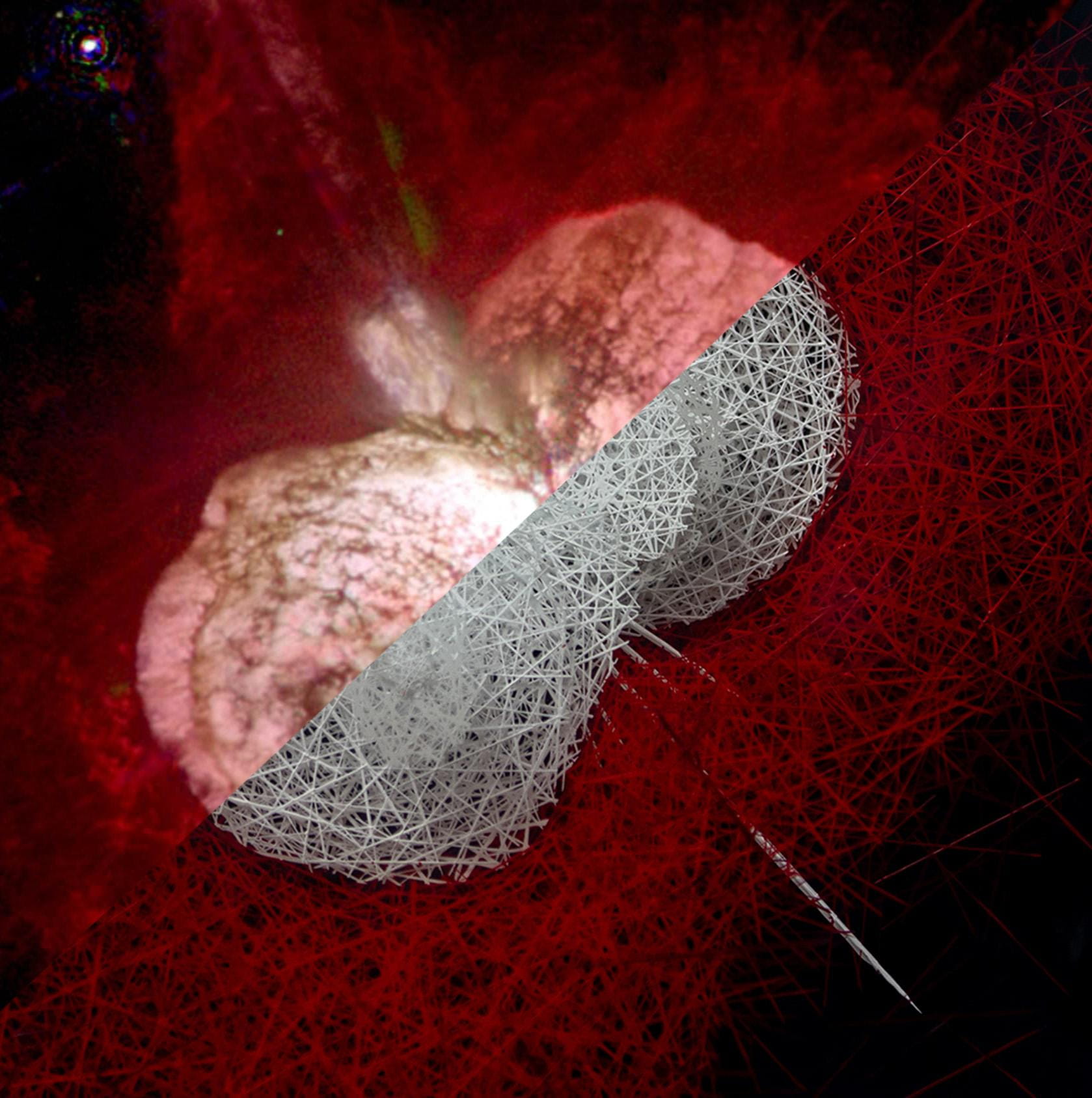 ETA CARINAE par Sébastien CRETEUR comparaison